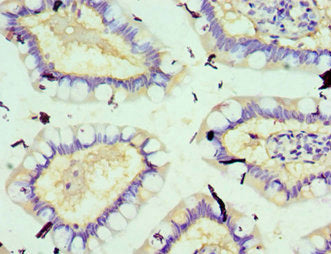 Immunohistochemistry of paraffin-embedded human small intestine tissue using CSB-PA022399ESR1HU at dilution of 1:100
