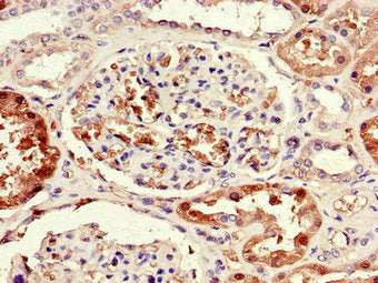 Immunohistochemistry of paraffin-embedded human kidney tissue using CSB-PA022410HA01HU at dilution of 1:100