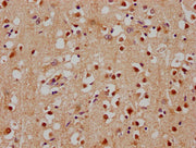 IHC image of CSB-PA022418OA01HU diluted at 1:100 and staining in paraffin-embedded human brain tissue performed on a Leica BondTM system. After dewaxing and hydration, antigen retrieval was mediated by high pressure in a citrate buffer (pH 6.0). S...
