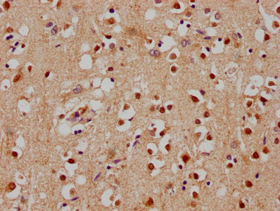 IHC image of CSB-PA022418OA01HU diluted at 1:100 and staining in paraffin-embedded human brain tissue performed on a Leica BondTM system. After dewaxing and hydration, antigen retrieval was mediated by high pressure in a citrate buffer (pH 6.0). S...
