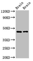 Western Blot Positive WB detected in: Rat brain tissue, Mouse brain tissue All lanes: SOX11 antibody at 2.7ug/ml Secondary Goat polyclonal to rabbit IgG at 1/50000 dilution Predicted band size: 47 kDa Observed band size: 47 kDa