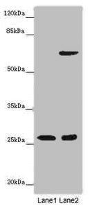 Western blot All lanes: SOX14 antibody at 14ug/ml Lane 1: Human placenta tissue Lane 2: HepG2 whole cell lysate Secondary Goat polyclonal to rabbit IgG at 1/10000 dilution Predicted band size: 27 kDa Observed band size: 27 kDa