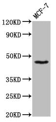 Western Blot Positive WB detected in: MCF-7 whole cell lysate All lanes: SOX3 antibody at 8.6µg/ml Secondary Goat polyclonal to rabbit IgG at 1/50000 dilution Predicted band size: 46 kDa Observed band size: 46 kDa