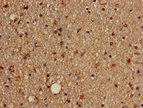Immunohistochemistry of paraffin-embedded human brain tissue using CSB-PA022431LA01HU at dilution of 1:100