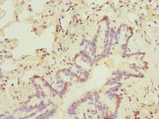 Immunohistochemistry of paraffin-embedded human lung tissue using CSB-PA022432DSR2HU at dilution of 1:100