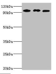 Western blot All lanes: SOX6 antibody at 10ug/ml Lane 1: Jurkat whole cell lysate Lane 2: Hela whole cell lysate Lane 3: 293T whole cell lysate Secondary Goat polyclonal to rabbit IgG at 1/10000 dilution Predicted band size: 92, 90, 89 kDa Observe...