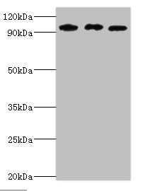Western blot All lanes: SOX6 antibody at 10ug/ml Lane 1: Jurkat whole cell lysate Lane 2: Hela whole cell lysate Lane 3: 293T whole cell lysate Secondary Goat polyclonal to rabbit IgG at 1/10000 dilution Predicted band size: 92, 90, 89 kDa Observe...