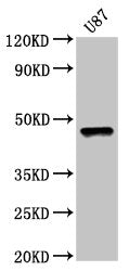 Western Blot Positive WB detected in: U87 whole cell lysate All lanes: SOX8 antibody at 5µg/ml Secondary Goat polyclonal to rabbit IgG at 1/50000 dilution Predicted band size: 48 kDa Observed band size: 48 kDa