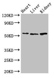 Western Blot Positive WB detected in: Mouse heart tissue, Mouse liver tissue, Mouse kidney tissue All lanes: SOX9 antibody at 3ug/ml Secondary Goat polyclonal to rabbit IgG at 1/50000 dilution Predicted band size: 57 kDa Observed band size: 57 kDa