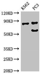 Western Blot Positive WB detected in: K562 whole cell lysate, PC-3 whole cell lysate All lanes: SP110 antibody at 2.7ug/ml Secondary Goat polyclonal to rabbit IgG at 1/50000 dilution Predicted band size: 79, 47, 62, 29, 82, 63 kDa Observed band si...