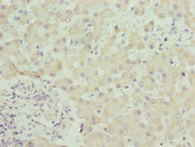 Immunohistochemistry of paraffin-embedded human liver tissue using CSB-PA022517LA01HU at dilution of 1:100