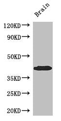 Western Blot Positive WB detected in: Mouse brain tissue All lanes: SPDEF antibody at 3ug/ml Secondary Goat polyclonal to rabbit IgG at 1/50000 dilution Predicted band size: 38, 36 kDa Observed band size: 38 kDa
