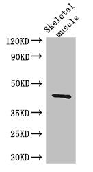 Western Blot Positive WB detected in: Mouse skeletal muscle tissue All lanes: SPHK1 antibody at 3ug/ml Secondary Goat polyclonal to rabbit IgG at 1/50000 dilution Predicted band size: 43, 52, 44 kDa Observed band size: 43 kDa