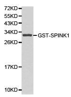 Western blot analysis of GST-SPINK1 recombinant protein using SPINK1 antibody.