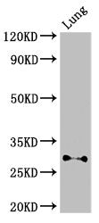 Western Blot Positive WB detected in: Mouse lung tissue All lanes: SPINT2 antibody at 3ug/ml Secondary Goat polyclonal to rabbit IgG at 1/50000 dilution Predicted band size: 29, 22 kDa Observed band size: 29 kDa