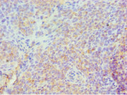 Immunohistochemistry of paraffin-embedded human tonsil tissue using CSB-PA022590ESR1HU at dilution of 1:100