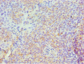 Immunohistochemistry of paraffin-embedded human tonsil tissue using CSB-PA022590ESR1HU at dilution of 1:100