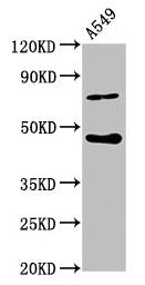 Western Blot Positive WB detected in: A549 whole cell lysate All lanes: SPOPL antibody at 6.3µg/ml Secondary Goat polyclonal to rabbit IgG at 1/50000 dilution Predicted band size: 45 kDa Observed band size: 45 kDa