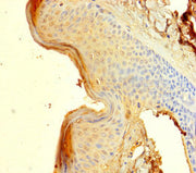 Immunohistochemistry of paraffin-embedded human skin tissue using CSB-PA022611LA01HU at dilution of 1:100