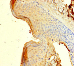 Immunohistochemistry of paraffin-embedded human skin tissue using CSB-PA022611LA01HU at dilution of 1:100
