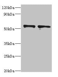 Western blot All lanes: SPTLC1 antibody at 8µg/ml Lane 1: 293T whole cell lysate Lane 2: MCF-7 whole cell lysate Secondary Goat polyclonal to rabbit at 1/10000 dilution Predicted band size: 53, 17 kDa Observed band size: 53 kDa