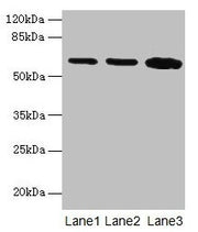 Western blot All lanes: SPTLC2 antibody at 12µg/ml Lane 1: HepG2 whole cell lysate Lane 2: A549 whole cell lysate Lane 3: HT29 whole cell lysate Secondary Goat polyclonal to rabbit IgG at 1/10000 dilution Predicted band size: 63 kDa Observed band...