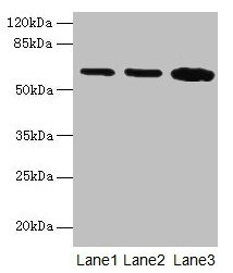 Western blot All lanes: SPTLC2 antibody at 12µg/ml Lane 1: HepG2 whole cell lysate Lane 2: A549 whole cell lysate Lane 3: HT29 whole cell lysate Secondary Goat polyclonal to rabbit IgG at 1/10000 dilution Predicted band size: 63 kDa Observed band...
