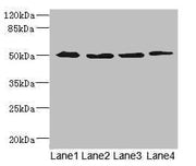 Western blot All lanes: SQRDL antibody at 4.67ug/ml Lane 1: A549 whole cell lysate Lane 2: A431 whole cell lysate Lane 3: Hela whole cell lysate Lane 4: HepG2 whole cell lysate Secondary Goat polyclonal to rabbit IgG at 1/10000 dilution Predicted...