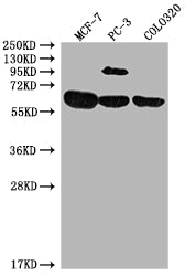 Western Blot Positive WB detected in: MCF-7 whole cell lysate, PC-3 whole cell lysate, COLO320 whole cell lysate All lanes: SRC antibody at 1:2000 Secondary Goat polyclonal to rabbit IgG at 1/50000 dilution Predicted band size: 60, 61 kDa Observed...