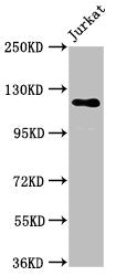 Western Blot Positive WB detected in: Jurkat whole cell lysate All lanes: SREBF1 antibody at 5.7µg/ml Secondary Goat polyclonal to rabbit IgG at 1/50000 dilution Predicted band size: 122, 114, 112, 125, 49, 46 kDa Observed band size: 122 kDa