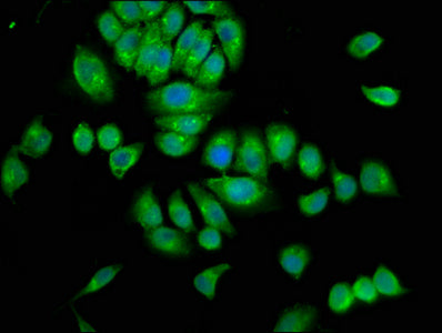 Immunofluorescence staining of A549 cells with CSB-PA022663LA01HU at 1:100, counter-stained with DAPI. The cells were fixed in 4% formaldehyde, permeabilized using 0.2% Triton X-100 and blocked in 10% normal Goat Serum. The cells were then incubat...