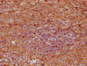 IHC image of CSB-PA022664EA01HU diluted at 1:400 and staining in paraffin-embedded human spleen tissue performed on a Leica BondTM system. After dewaxing and hydration, antigen retrieval was mediated by high pressure in a citrate buffer (pH 6.0)....