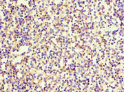 Immunohistochemistry of paraffin-embedded human spleen tissue using CSB-PA022664ESR1HU at dilution of 1:100