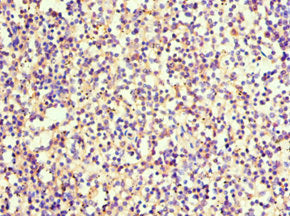 Immunohistochemistry of paraffin-embedded human spleen tissue using CSB-PA022664ESR1HU at dilution of 1:100
