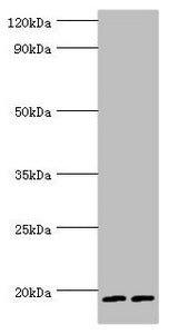 Western blot All lanes: Serglycin antibody at 9ug/ml Lane 1: THP-1 whole cell lysate Lane 2: HL60 whole cell lysate Secondary Goat polyclonal to rabbit IgG at 1/10000 dilution Predicted band size: 18 kDa Observed band size: 18 kDa