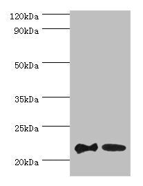 Western blot All lanes: SRI antibody at 2µg/ml Lane 1: HepG2 whole cell lysate Lane 2: Hela whole cell lysate Secondary Goat polyclonal to rabbit at 1/10000 dilution Predicted band size: 22, 21 kDa Observed band size: 22 kDa