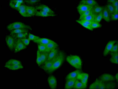 Immunofluorescence staining of HepG2 cells with CSB-PA022673LA01HU at 1:133, counter-stained with DAPI. The cells were fixed in 4% formaldehyde, permeabilized using 0.2% Triton X-100 and blocked in 10% normal Goat Serum. The cells were then incuba...