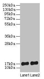 Western blot All lanes: SRP19 antibody at 2µg/ml Lane 1: Jurkat whole cell lysate Lane 2: Hela whole cell lysate Secondary Goat polyclonal to rabbit lgG at 1/15000 dilution Predicted band size: 17, 13, 9 kDa Observed band size: 17 kDa