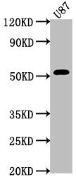 Western Blot Positive WB detected in: U87 whole cell lysate All lanes: SRPX antibody at 1:2000 Secondary Goat polyclonal to rabbit IgG at 1/50000 dilution Predicted band size: 52, 50, 46, 42 kDa Observed band size: 52 kDa