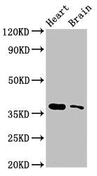 Western Blot Positive WB detected in: Mouse heart tissue, Mouse brain tissue All lanes: SRR antibody at 3ug/ml Secondary Goat polyclonal to rabbit IgG at 1/50000 dilution Predicted band size: 37 kDa Observed band size: 37 kDa