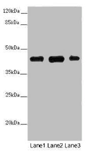 Western blot All lanes: SS18L1 antibody at 2 ug/ml Lane 1: Mouse kidney tissue Lane 2: Mouse lung tissue Lane 3: Mouse spleen tissue Secondary Goat polyclonal to rabbit IgG at 1/10000 dilution Predicted band size: 43, 41, 34, 30, 44 kDa Observed b...