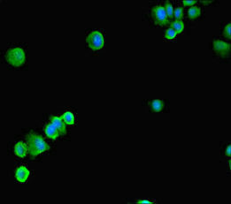 Immunofluorescent analysis of HepG2 cells using CSB-PA022721LA01HU at dilution of 1:100 and Alexa Fluor 488-congugated AffiniPure Goat Anti-Rabbit IgG(H+L)