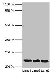 Western blot All lanes: SSSCA1 antibody at 2µg/ml Lane 1: A549 whole cell lysate Lane 2: MCF-7 whole cell lysate Lane 3: 293T whole cell lysate Secondary Goat polyclonal to rabbit IgG at 1/10000 dilution Predicted band size: 22 kDa Observed band s...