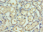 Immunohistochemistry of paraffin-embedded human kidney tissue using CSB-PA022738ESR2HU at dilution of 1:100