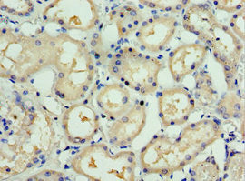 Immunohistochemistry of paraffin-embedded human kidney tissue using CSB-PA022738ESR2HU at dilution of 1:100