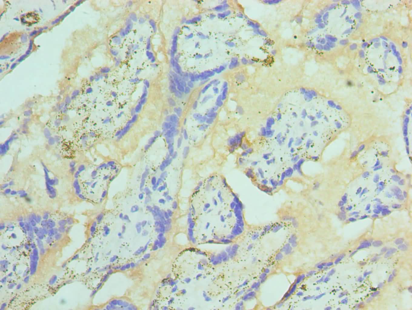 Immunohistochemistry of paraffin-embedded human placenta tissue using CSB-PA022746ESR1HU at dilution of 1:100