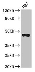 Western Blot Positive WB detected in: U87 whole cell lysate All lanes: ST8SIA5 antibody at 3.5µg/ml Secondary Goat polyclonal to rabbit IgG at 1/50000 dilution Predicted band size: 44, 48 kDa Observed band size: 44 kDa