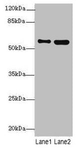 Western blot All lanes: STAM2 antibody at 4.09µg/ml Lane 1: 293T whole cell lysate Lane 2: Hela whole cell lysate Secondary Goat polyclonal to rabbit IgG at 1/10000 dilution Predicted band size: 59, 39 kDa Observed band size: 59 kDa