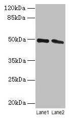 Western blot All lanes: STAMBP antibody at 12µg/ml Lane 1: Jurkat whole cell lysate Lane 2: Hela whole cell lysate Secondary Goat polyclonal to rabbit IgG at 1/10000 dilution Predicted band size: 49, 40 kDa Observed band size: 49 kDa