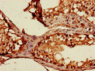 Immunohistochemistry of paraffin-embedded human testis tissue using CSB-PA022810LA01HU at dilution of 1:100